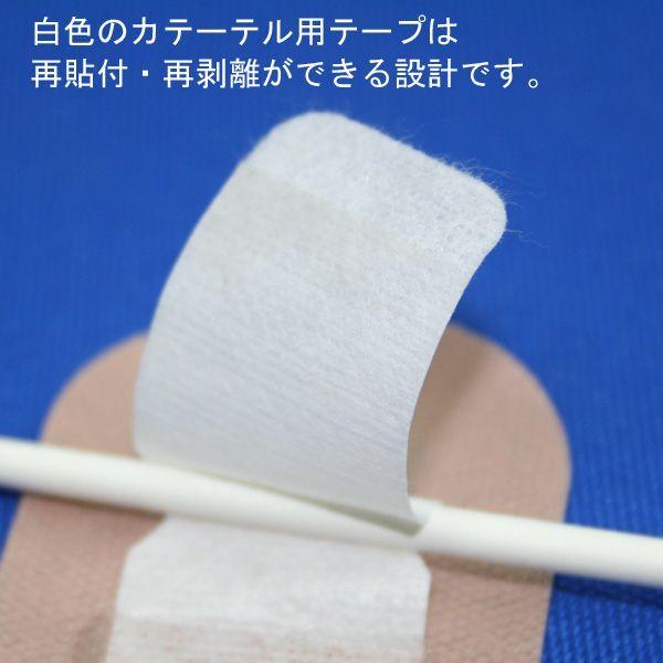 ALCARE（アルケア） クイックフィックス 3号（36Fr以下 カテーテル固定